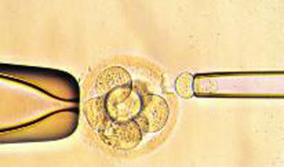 严重少弱精案例